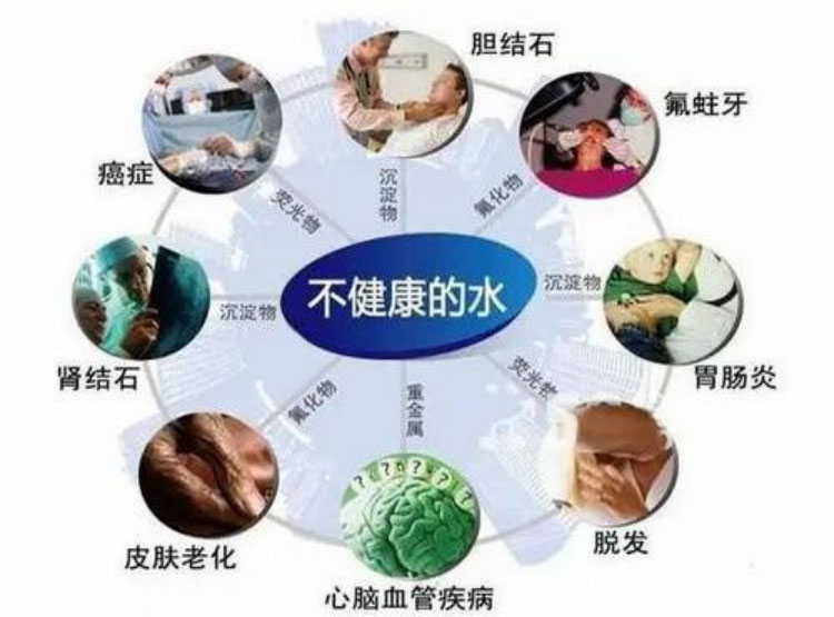 健身房的健康保障：5A净水云仓净水器让你运动后放心补水